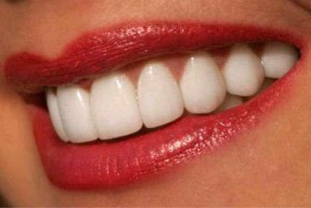 Услуги стоматолога: Установка металлокерамических коронок