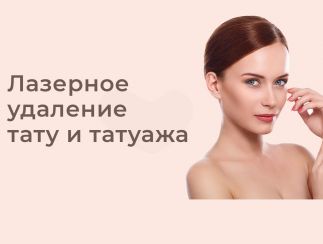 Лазерное удаление тату и татуажа в Алматы