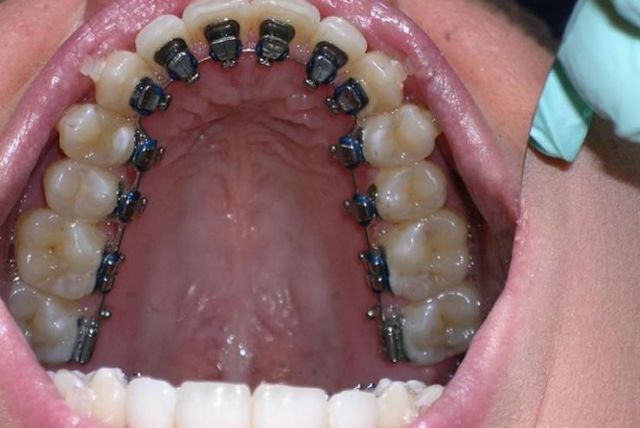 Стоматологическая клиника Стоматологическая клиника "Дентал"